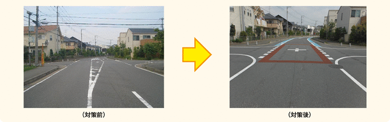 図表5－29　ゾーン30の整備事例（中央線の抹消）（埼玉県さいたま市）