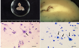 Microscopic images of brain samples.