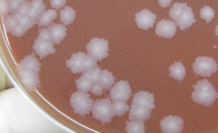 Colonies of B. anthracis