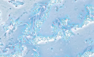 炭疽菌の芽胞及び莢膜発現増殖型（ビクトリアブルー単染色）