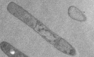 炭疽菌の増殖型（透過型電子顕微鏡写真）